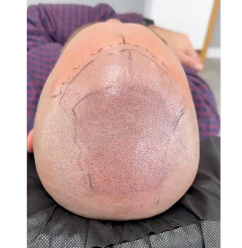 zdjęcie whatsapp 2025 11 07 o 19.24.32 d17a8f4a