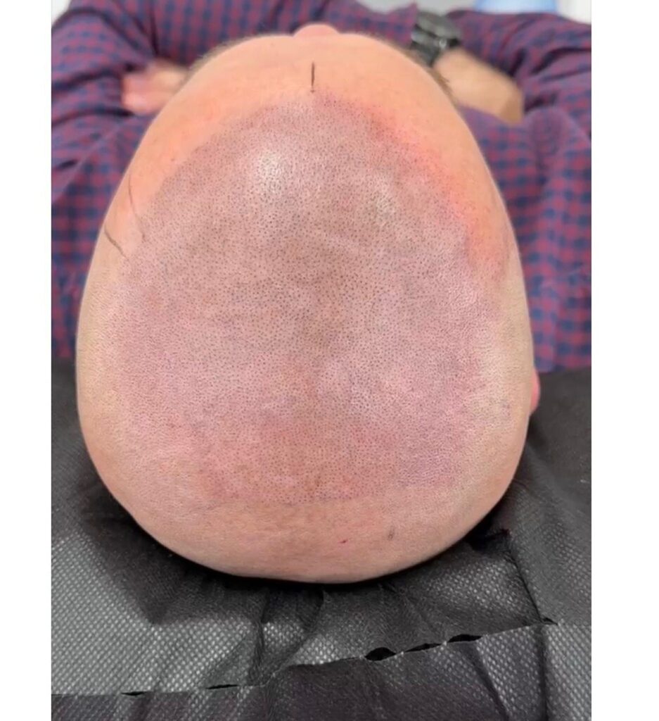 zdjęcie whatsapp 2025 11 07 o 19.24.32 d65f9b51